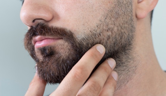 Beard and Eyebrow Transplantation