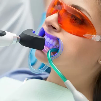 Teeth Whitening
