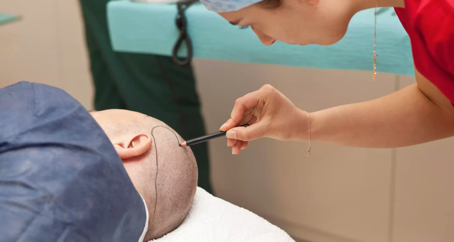What is Hair Transplantation and how is it performed?