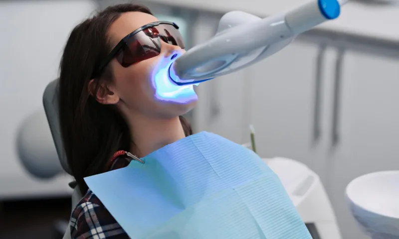 Sbiancamento Dentale