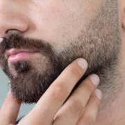 Greffe de Barbe