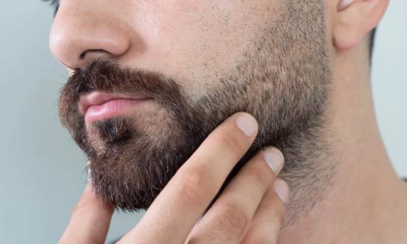 Greffe de Barbe
