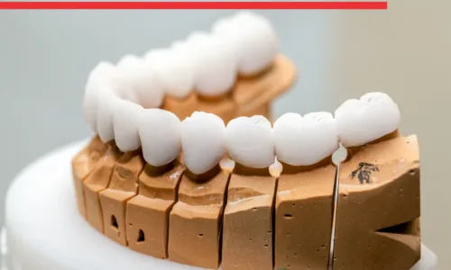 Rivestimento in Zirconio