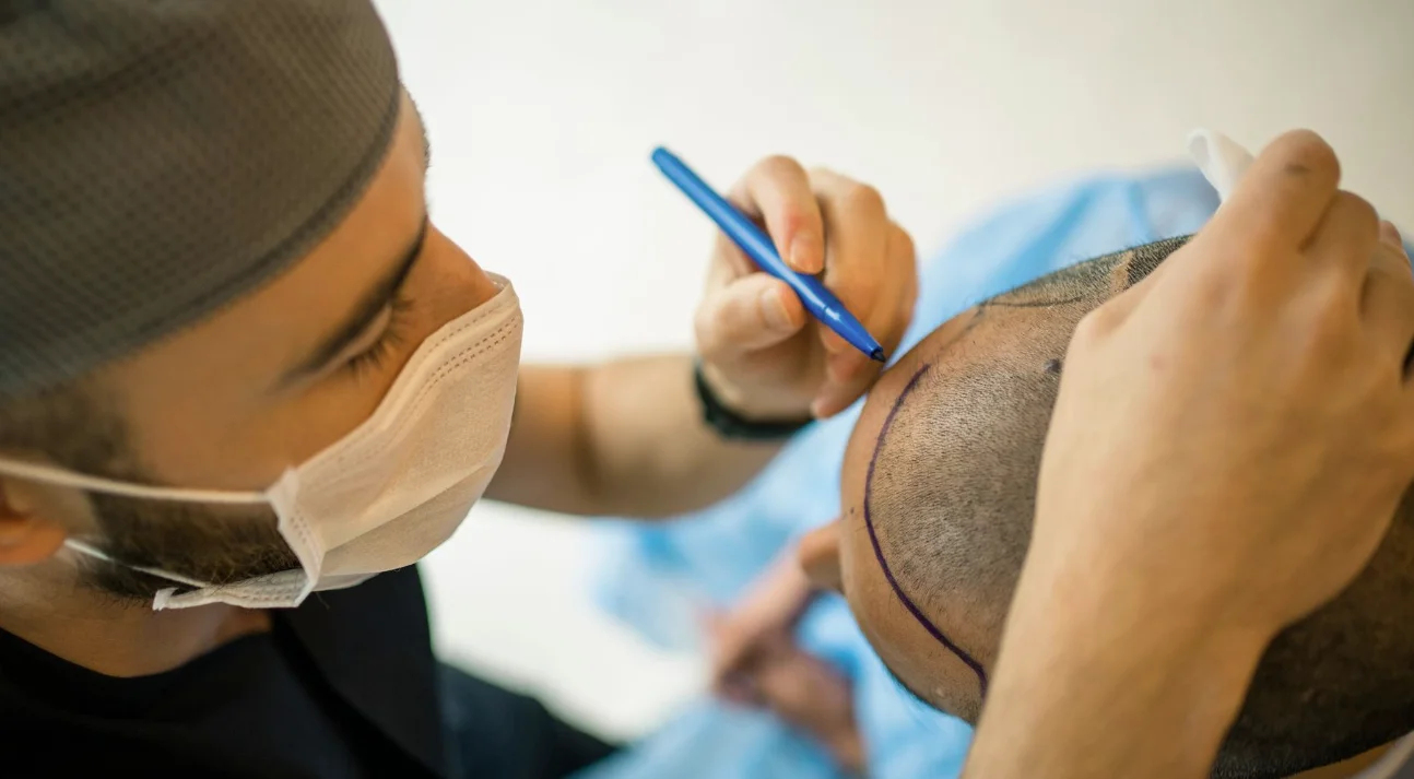 Saç Ekiminde Merdivenaltı Kliniklerden Uzak Durun