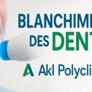 Blanchiment des Dents