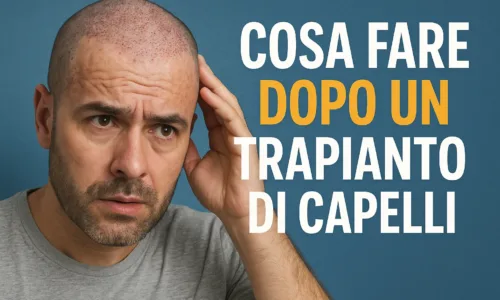 Cosa Fare Dopo un Trapianto di Capelli