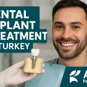 Dental Implant Treatment in Turkey
