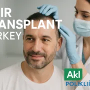 Hair Transplant Turkey