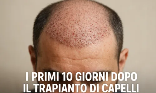 I Primi 10 Giorni Dopo il Trapianto di Capelli