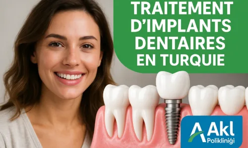 Traitement d’Implants Dentaires en Turquie
