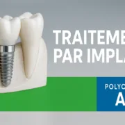 Traitement par Implant