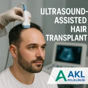 Ultrasound Hair Transplantation