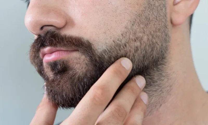 Greffe de barbe et de sourcils
