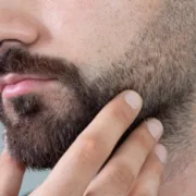 Beard and Eyebrow Transplantation