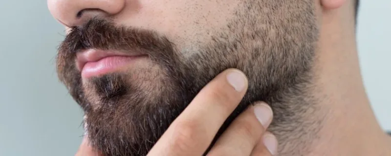 Beard and Eyebrow Transplantation