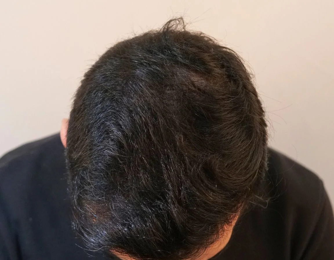 Cheveux après - AKL