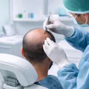 Istanbul Hair Transplant